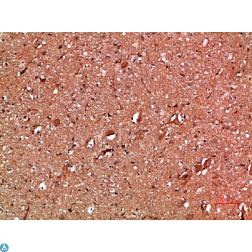 Polyclonal Rabbit anti-Human ANXA1 / Annexin A1 Antibody (IHC, WB)