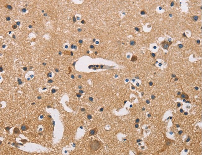 ATP2C1 Antibody