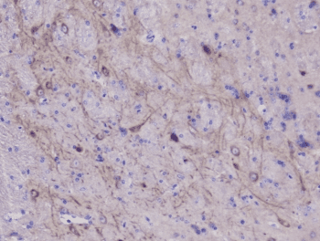 Polyclonal Rabbit anti-Human ENO2 / NSE Antibody (IHC, WB)