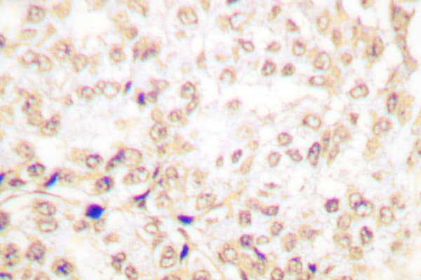 Polyclonal Rabbit anti-Human XRCC5 / Ku80 Antibody (Ala717, IHC, WB)