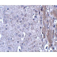 Polyclonal Rabbit anti-Human MATN4 / Matrilin 4 Antibody (IHC, IF, WB)