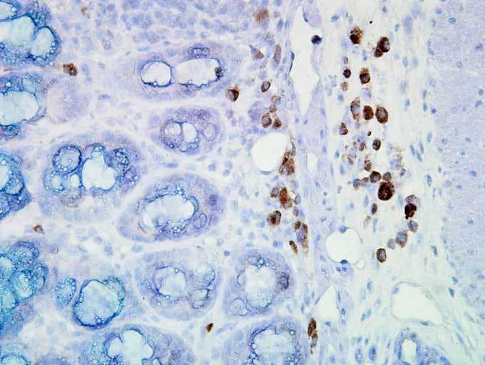 HSP90 / Heat Shock Protein 90 Antibody (clone D7A)