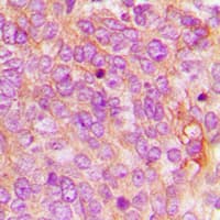 Polyclonal Rabbit anti-Human IFIH1 / MDA5 Antibody (C-Terminus, IHC, IF, WB)