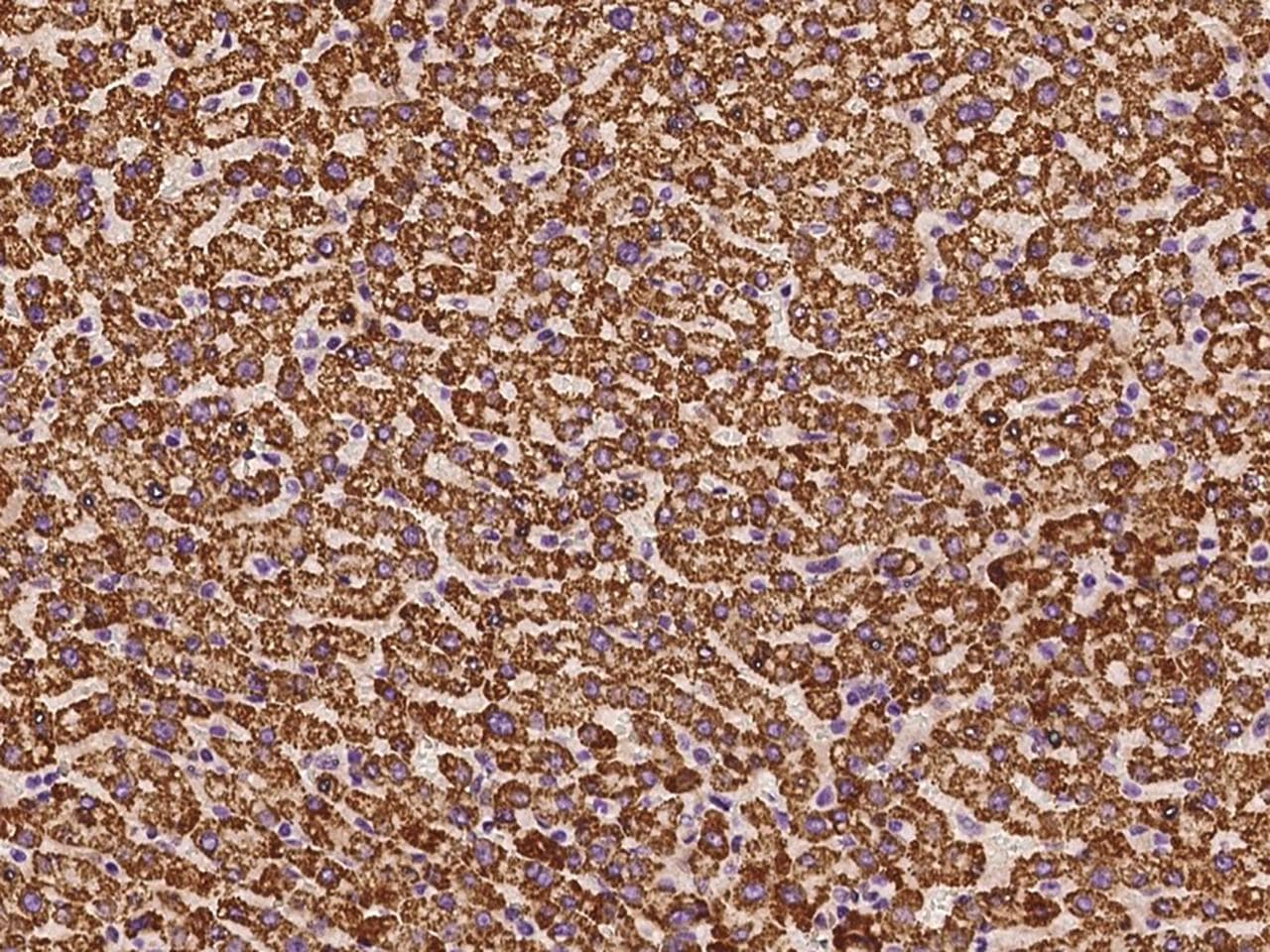 P5CDH / ALDH4A1 Antibody