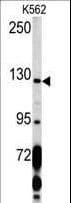 PDGFRA / PDGFR Alpha Antibody (aa1048-1077)