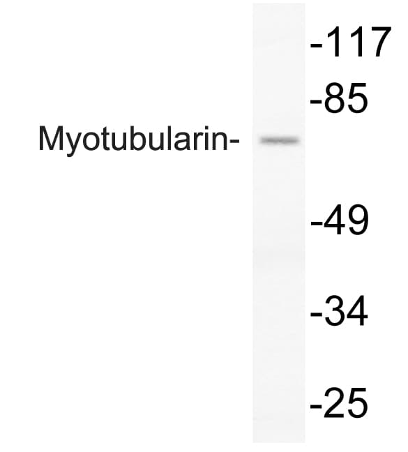 MTM1 / Myotubularin Antibody (aa241-290)