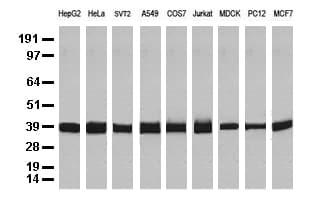 Monoclonal Mouse anti-Human GAPDH Antibody (clone OTI2D9, WB)