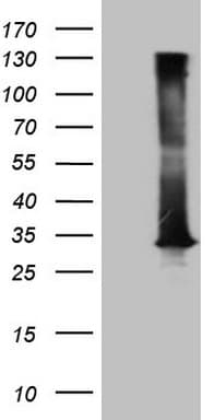 Monoclonal Mouse anti-Human DECR1 Antibody (clone OTI10A11, Carrier-free, IHC, WB)