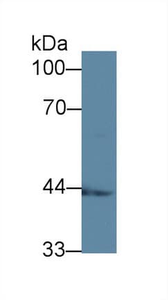 SCAD / ACADS Antibody (APC)