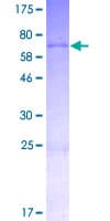 Human SAC3D1 Protein (Recombinant GST)