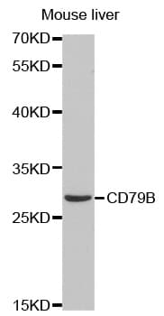 Polyclonal Rabbit anti-Human CD79B / CD79 Beta Antibody (IHC, IF, WB)