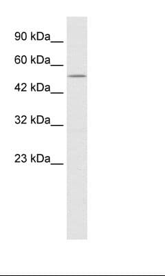 Polyclonal Rabbit anti-Human NMUR2 Antibody (N-Terminus, IHC, WB)