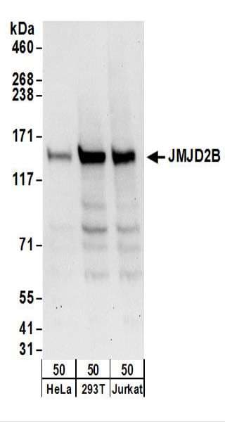 IHC-plus™ Polyclonal Rabbit anti-Human KDM4B / JMJD2B Antibody (aa1056-1096, IHC, WB)