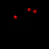 Polyclonal Rabbit anti-Human U2AF2 / U2AF65 Antibody (IF, WB)