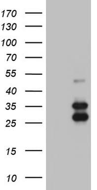 IRAK2 / IRAK-2 Antibody (aa362-625, clone OTI2B7)