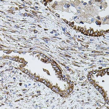SHH / Sonic Hedgehog Antibody