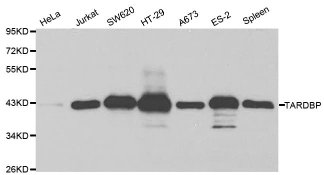 TDP-43 / TARDBP Antibody