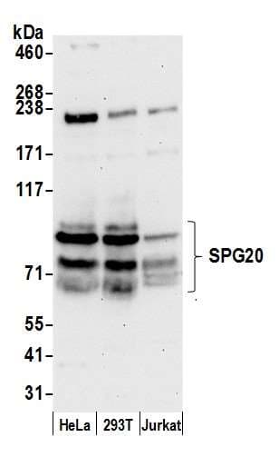 Polyclonal Rabbit anti-Human SPG20 / SPARTIN Antibody (aa350-400, WB)