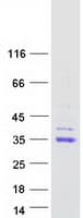 Human CA-VB / CA5B Protein (Recombinant Myc-DDK (Flag))