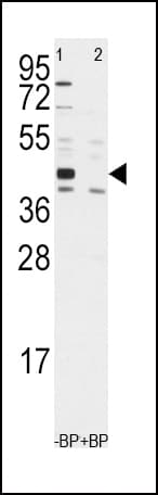 IHC-plus™ Polyclonal Rabbit anti-Human ALDH1A3 Antibody (aa318-348, IHC, WB)