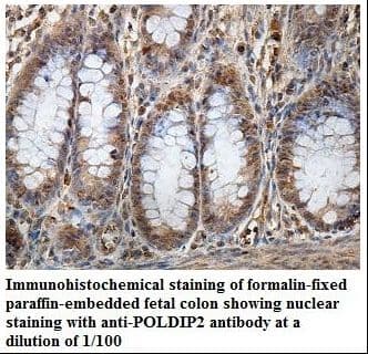 POLDIP2 / PDIP38 Antibody (aa171-353)