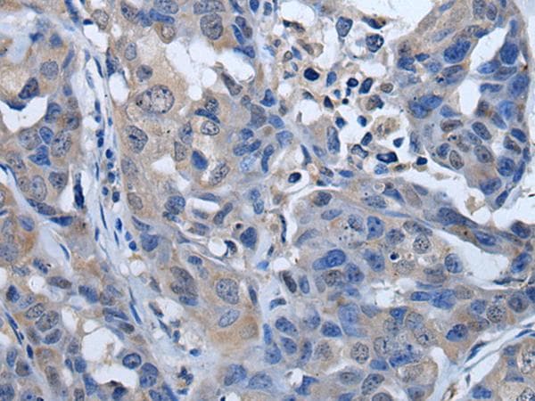 Polyclonal Rabbit anti-Human PLK4 / SAK Antibody (IHC)