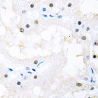 FOXC1+2 Antibody (Internal)