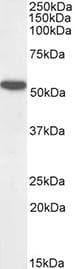 TPH1 / Tryptophan Hydroxylase Antibody