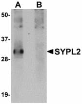 IHC-plus™ Polyclonal Rabbit anti-Human SYPL2 Antibody (IHC, IF, WB)