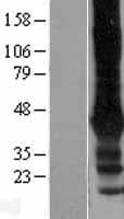 KCNJ6 / GIRK2 Protein (Over-Expression Lysate Myc-DDK (Flag))