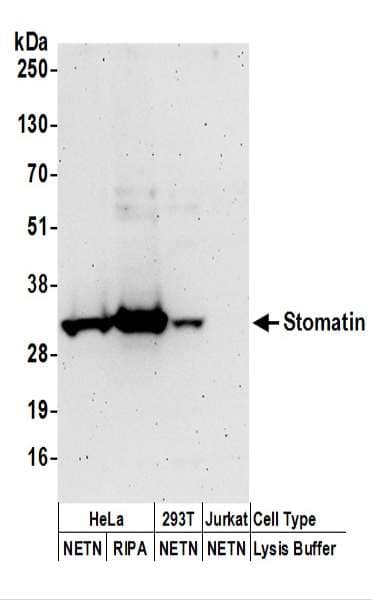 STOM / Stomatin Antibody (aa238-288)