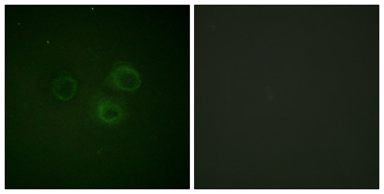 Polyclonal Rabbit anti-Human DNAM-1 / CD226 Antibody (phospho-Ser329, IHC, IF, WB)