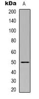 TUBB1 / Tubulin Beta 1 Antibody