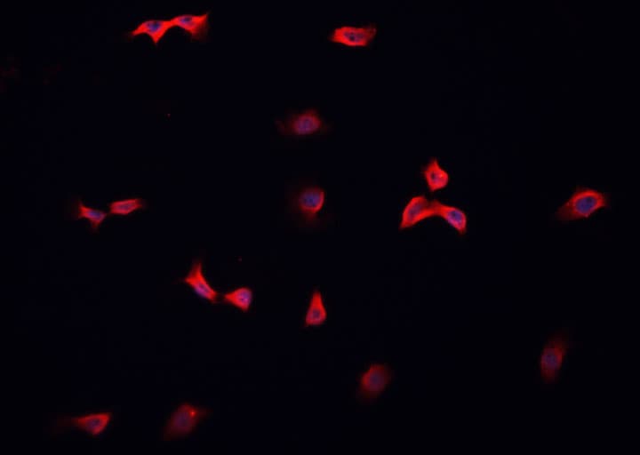 Polyclonal Rabbit anti-Human SCGB2A2 / Mammaglobin A Antibody (IHC, IF, WB)