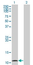 CCL15 / MIP5 Antibody (clone 1D7)