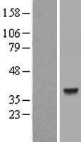 LDHC / Lactate Dehydrogenase C Protein (Over-Expression Lysate Myc-DDK (Flag))