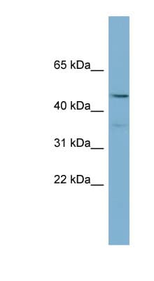 PPARA / PPAR Alpha Antibody (aa179-228)