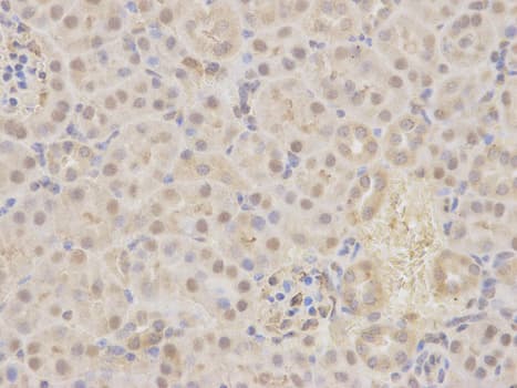 Polyclonal Rabbit anti-Human MAP2K7 / MEK7 Antibody (IHC, IF, WB)