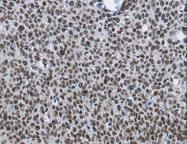 CMTM2 Antibody