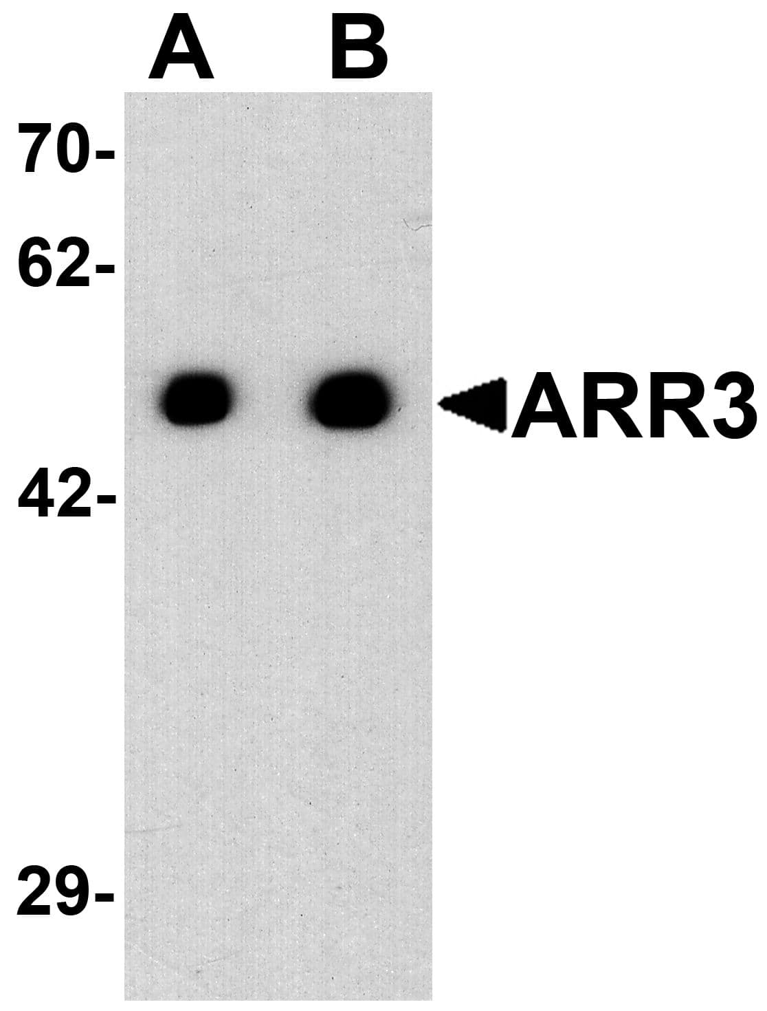 IHC-plus™ Polyclonal Rabbit anti-Human ARR3 / Cone Arrestin Antibody (IHC, IF, WB)
