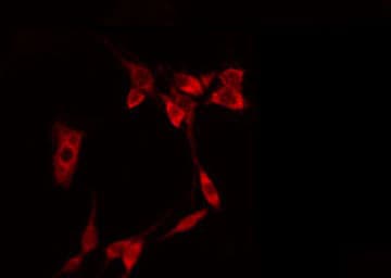 EIF4E Antibody (phospho-Ser209)