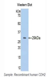 CDH2 / N Cadherin Antibody (aa50-276)