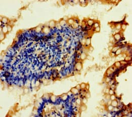 FTSJ2 Antibody