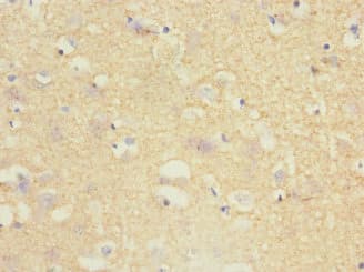 TPPP Antibody