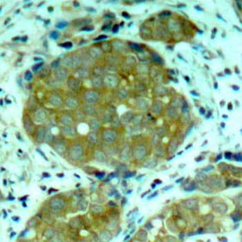 NFKB1 / NF-Kappa-B Antibody (phospho-Ser932)