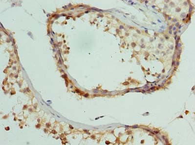 CCDC97 Antibody (Coiled-coil domain)
