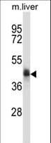 Polyclonal Rabbit anti-Human NADK2 / C5orf33 Antibody (aa122-150, IHC, WB)