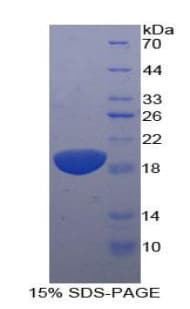 Human IL11RA Protein (Recombinant His)