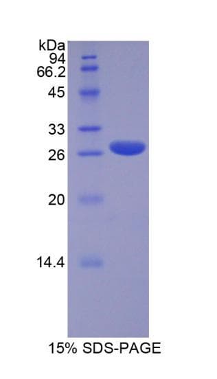 Human CBFA1 / RUNX2 Protein (Recombinant His)