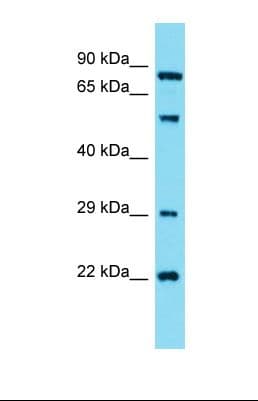 Polyclonal Rabbit anti-Human GUCY1A2 Antibody (aa128-177, WB)